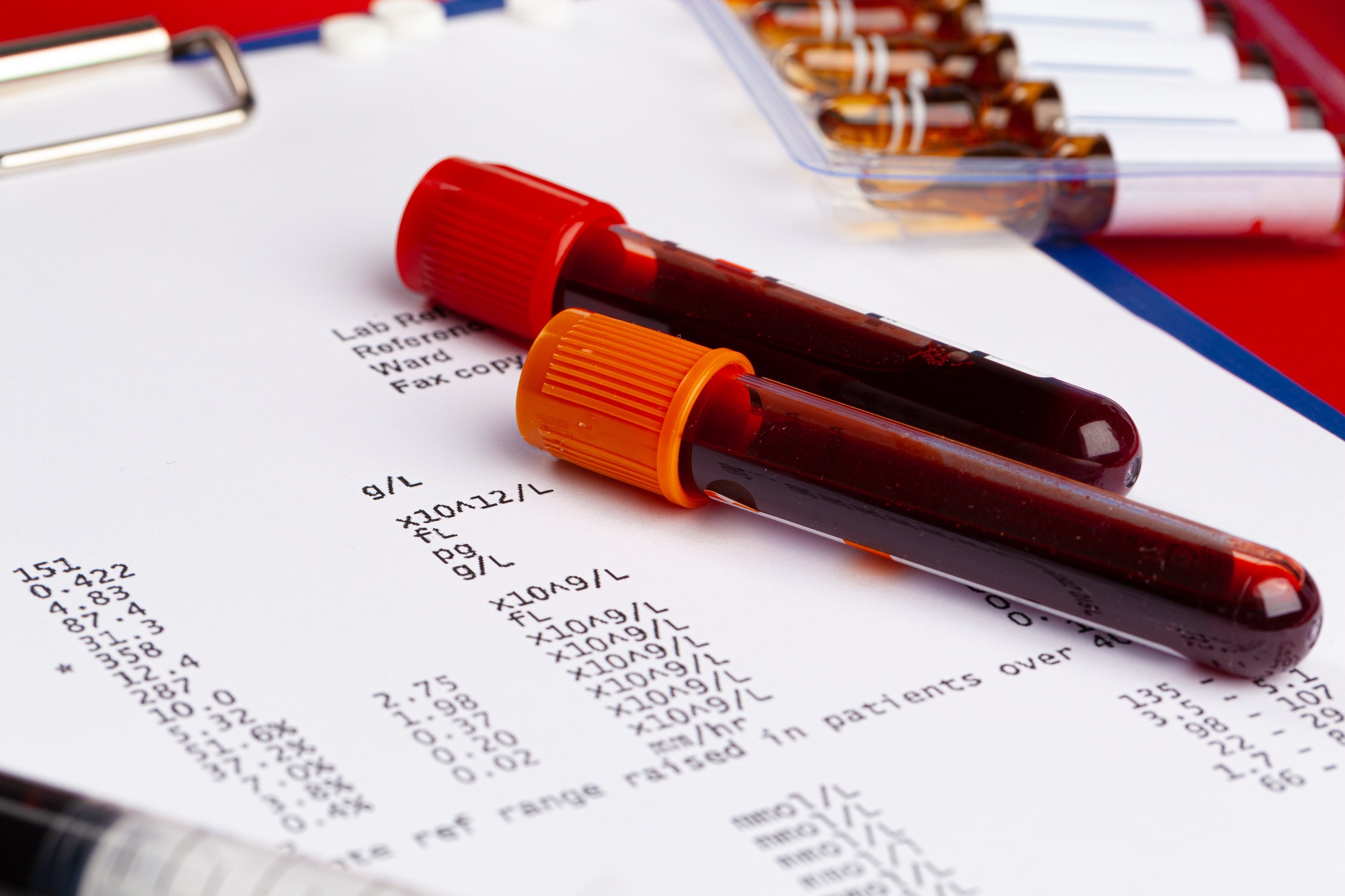 Coronavirus diagnostic and treatment concept. Laboratory table close up