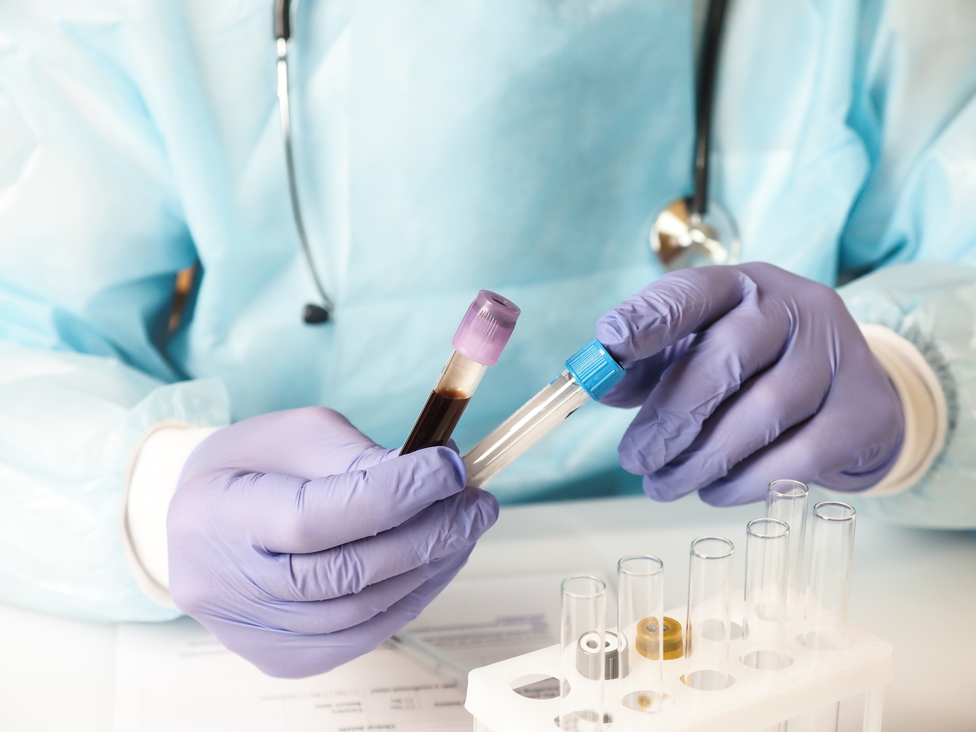 Doctor holding a blood test tube